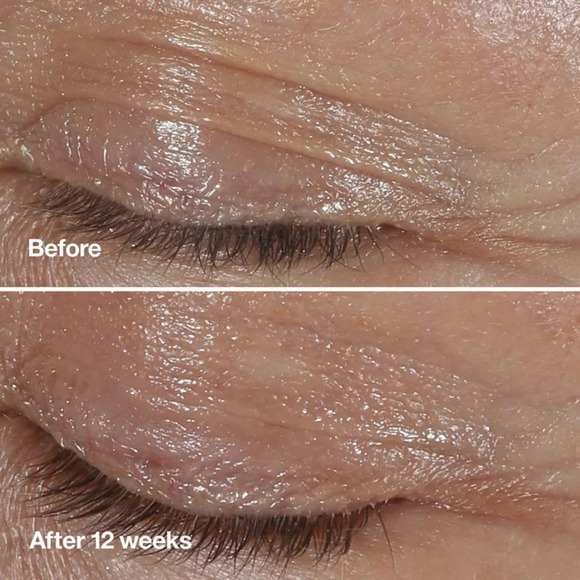 LAST 1! Clinique Smart Clinical Repair Wrinkle Correcting Eye Cream ποΈ NEW - Picture 4 of 11